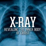 X-Ray Launch -- Diagnosis